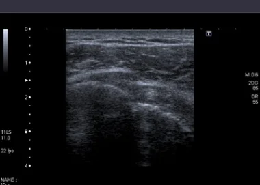 Wat kan echografie bij de fysiotherapeut voor u betekenen?